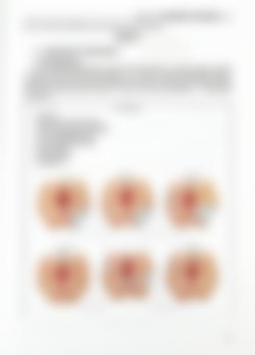 【广宁爱思特整形外科医院特色项目：】