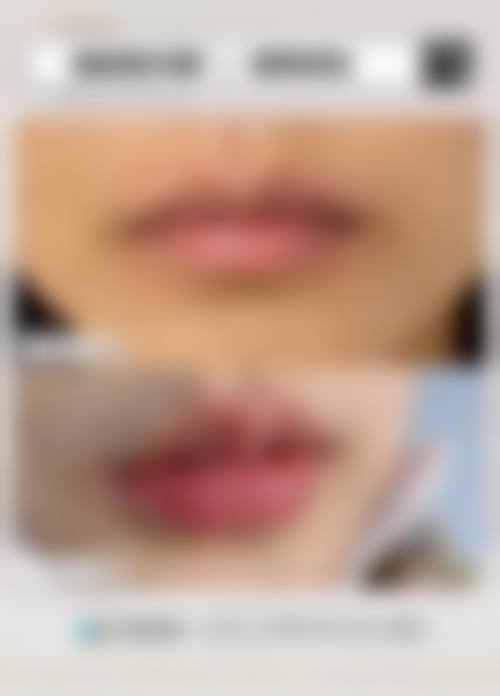 【北京斯迈尔医疗美容诊所参考价格表:】