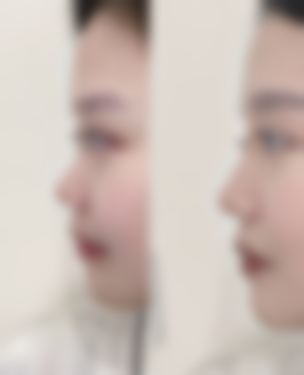 【广州美涵医学美容医院参考价格表:】