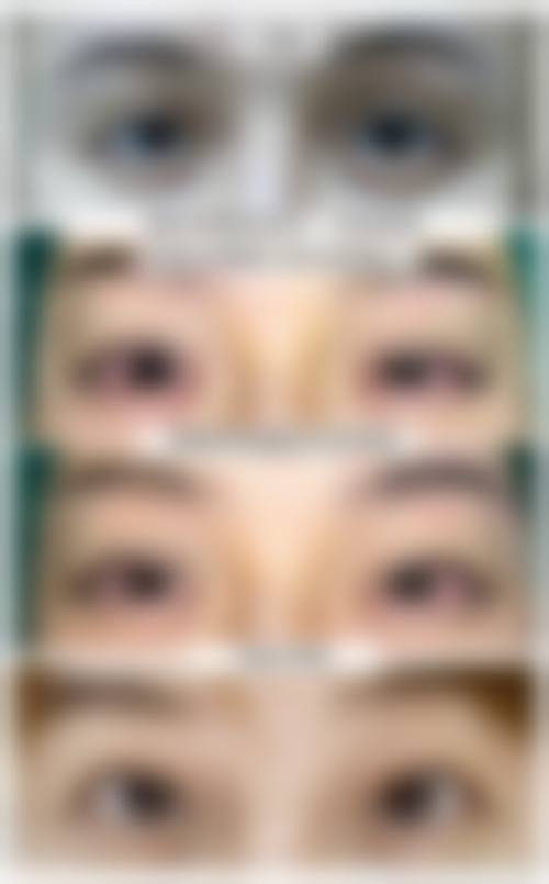 【哈尔滨第二医院整形科特色项目：】