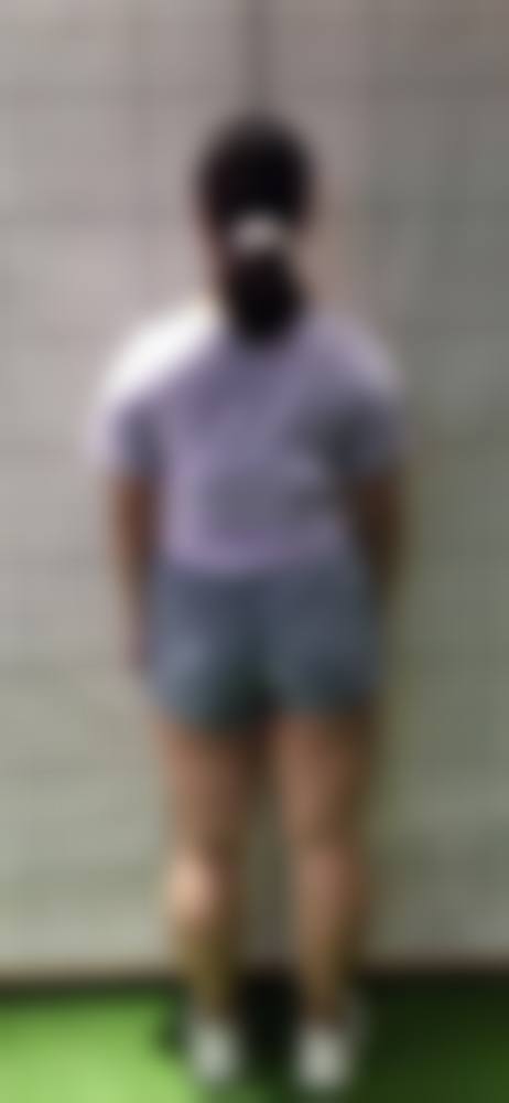 【上海光博士皮肤美容医院参考价格表：】