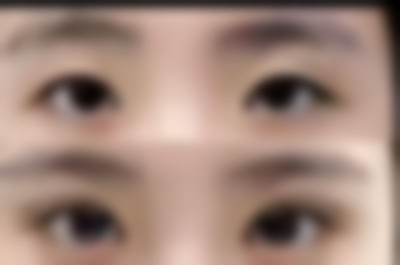 门诊提供的项目丰富多样，涵盖了皮肤美容、微整形、体型雕塑等多个领域。具体的特色项目有洗牙、牙贴面、垫鼻基底、激光类脱毛、治疗狐臭、MISKO隆鼻等。这些项目就像一个个精美的礼物盒，满足着不同顾客对于美的各种期待。无论是想要改善肌肤问题，还是进行面部轮廓的微调，亦或是塑造理想的身材曲线，在这里都能找到适合自己的项目。