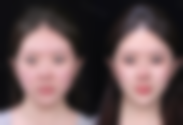 【苏州艺美格整形医院患者口碑评价：】