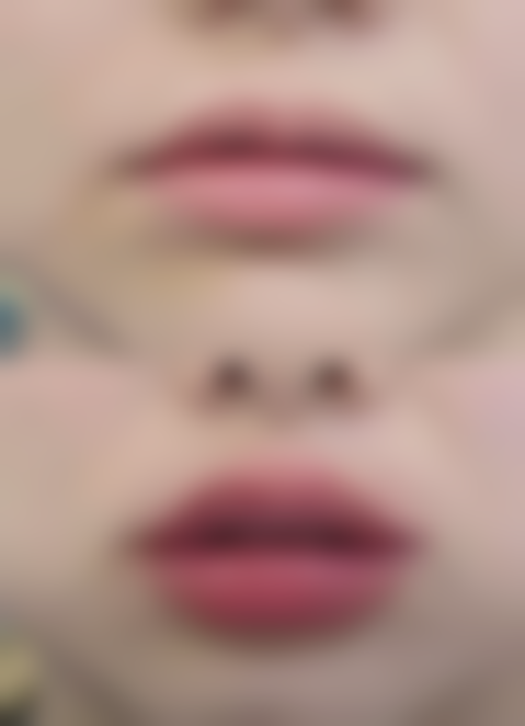 门诊配备了国内外领跑的医疗美容设备，例如激光美容仪和微创整形设备等。激光美容仪就像是一位神奇的魔法师，能够精细地作用于皮肤问题，如色斑、细纹等，在确保安心的前提下，有效地改善肌肤状况。微创整形设备则以其精细度和安心性，为整形手术提供了有力的保护，让手术过程更加精细、效率高。这些精良的设备就像门诊的得力助手，为高质量的医疗服务提供了坚实的技术支持。