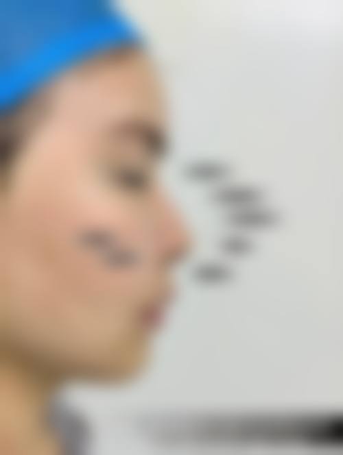 【长沙雅美医疗美容医院地址：】