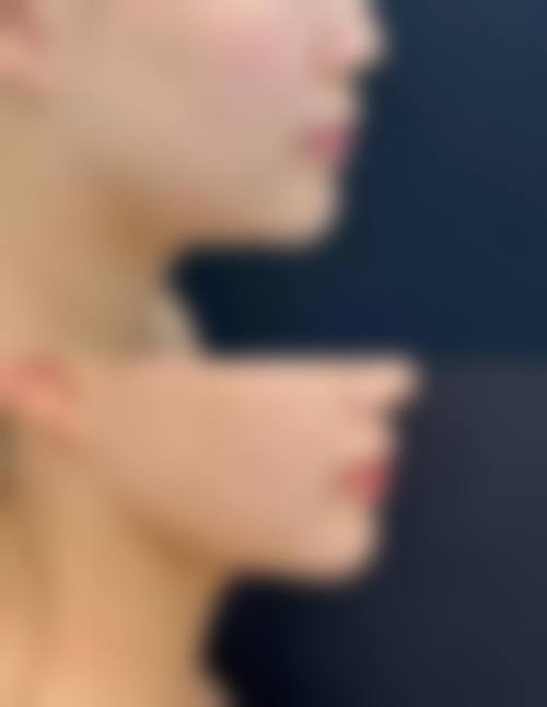 【长沙雅美医疗美容医院是正规的吗?】