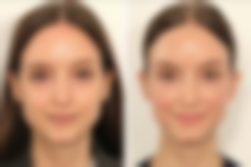 【厦门思明洛依初颜整形医院参考价格表：】