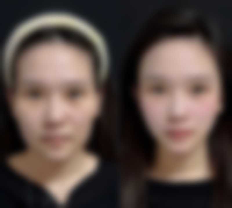 【宜昌蕾蒂整形核心优势：】