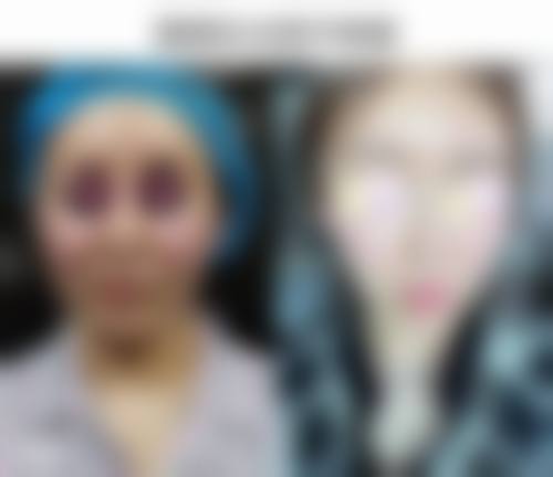 10个月宝宝咬下嘴唇怎么办