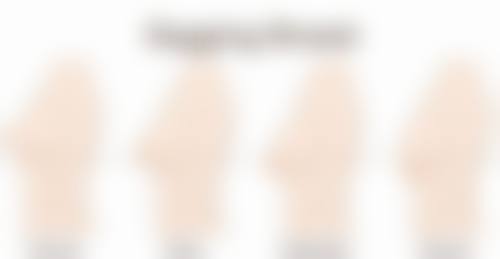 注射 Botox 除皱前后对比成效