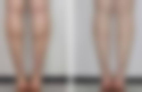 毛发种植可行吗