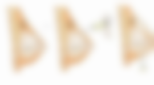 激光美白脸部一次多少钱