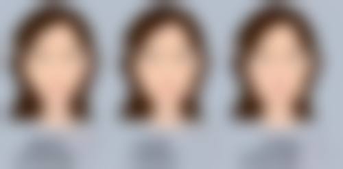 打美白针真的可以变白吗