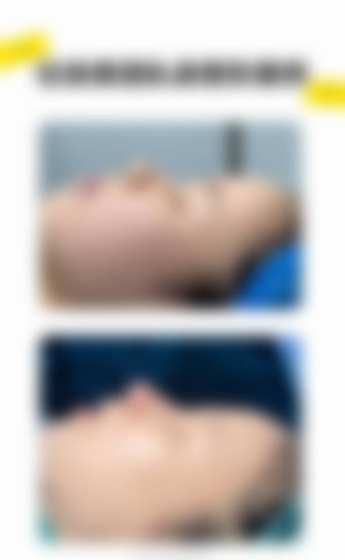 眉山仁寿好一点医疗美容诊所提供的特色项目还挺丰富的，有面部整形手术、注射美容、激光护肤、皮肤美容、微整形、激光治疗等。这些项目基本上能涵盖不同患者对于美的追求和需求，无论是想要进行大刀阔斧改变的面部整形，还是进行一些微调的微整形、注射美容，或者是专注于皮肤改善的激光护肤等项目，在这里都能找到合适的。