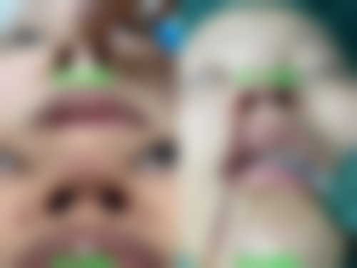 【襄阳百年整形医疗美容门诊部诊疗设备：】