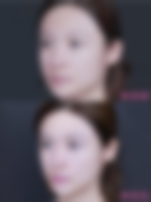 【王坤医生擅长项目：】