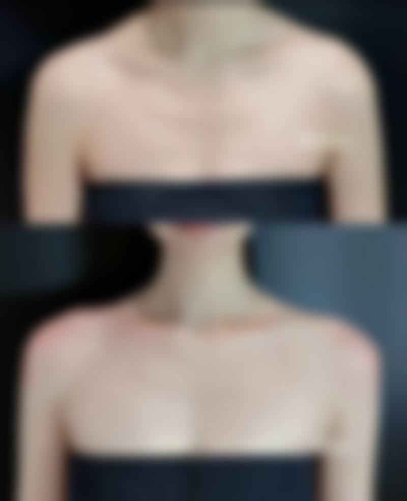 美白针多少钱一针能够维持多久