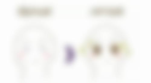 打了瘦脸针以后不打会不会反弹更大