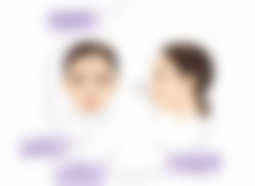 瘦脸针打一次维持多久