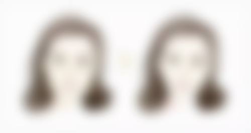 瘦脸针能让下颌线明显吗