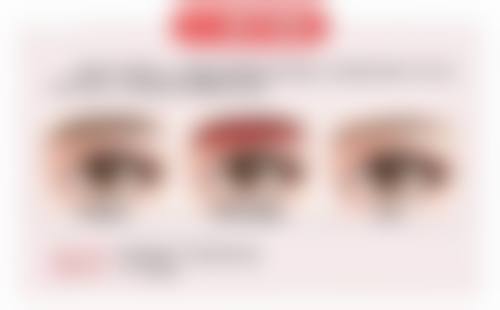 选择瘦脸针的相关知识