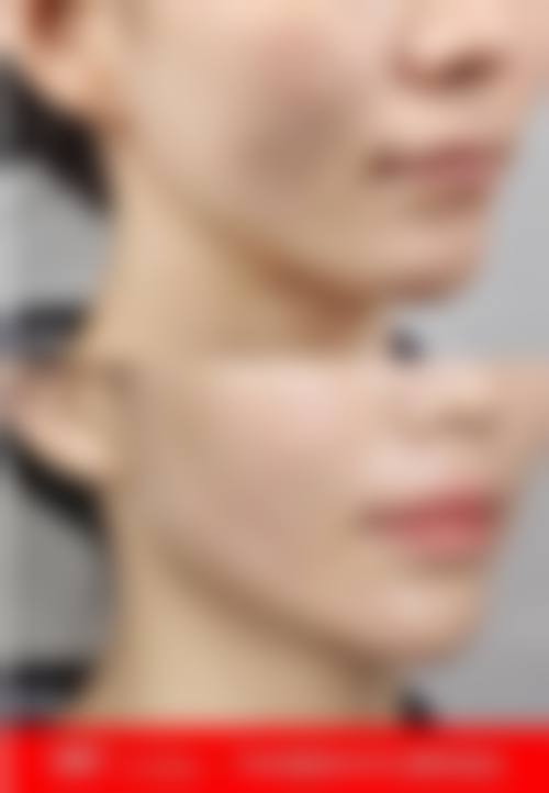 【湖南容艺医疗美容参考价格表:】