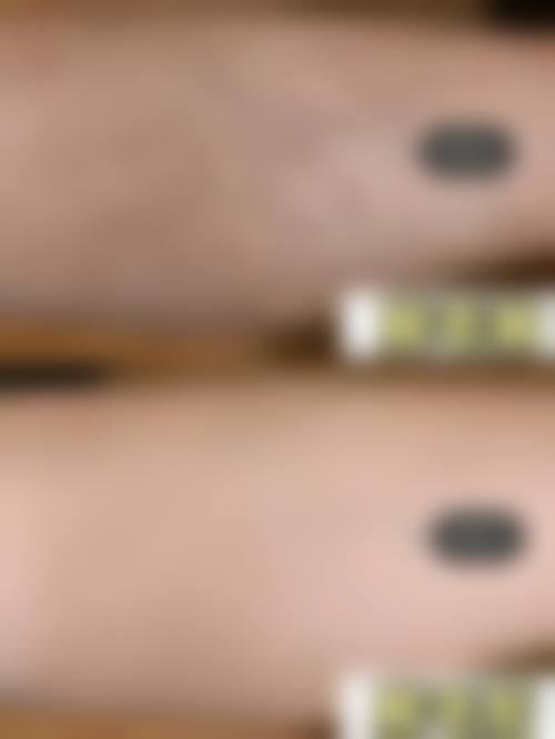 【张枫医生擅长项目】