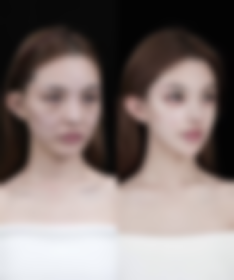 瘦脸针后悔了怎么快速代谢？掌握这5种科学方法，让你安全有效恢复自然脸型，告别后悔烦恼！ 