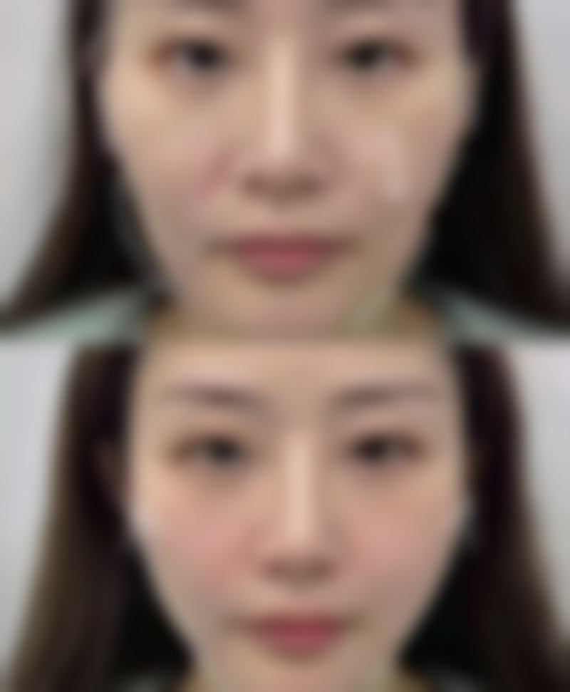 阴道紧缩术多大年龄可以做