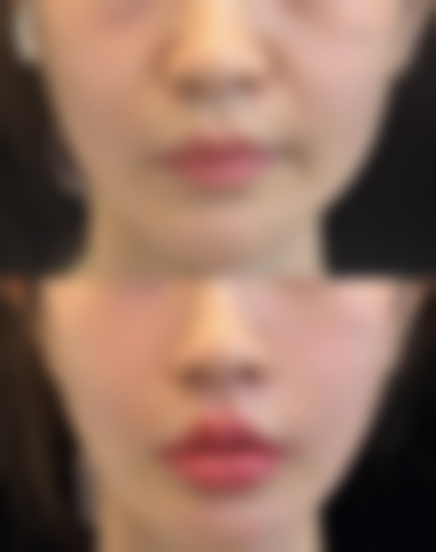 【北京焕颜嘉人医疗美容诊所特色项目：】