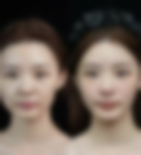 【杭州韩加医疗美容门诊部参考价格表:】