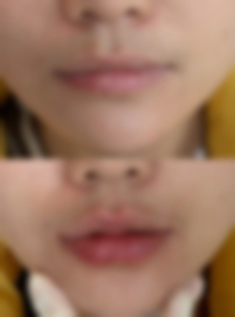 想快速代谢的方法之物理方式