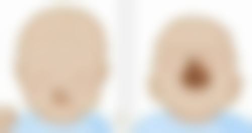 有永久性的瘦脸针吗？揭秘医美打脸真相，3种常见方法效果大不同！适合你的才是王道 