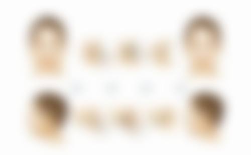 头发种植能保持多久时间