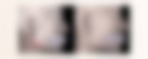 打瘦脸针脸歪了还能修复吗