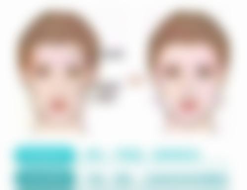 有恒久性的瘦脸针吗知乎热议