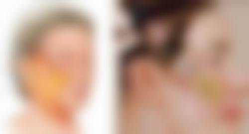 整脸拉皮除皱能顶多少年