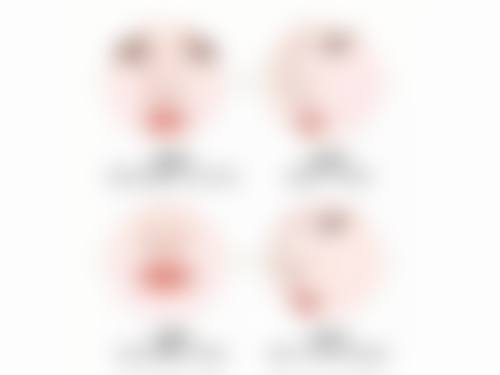 选择玻尿酸填充太阳穴的注意事项