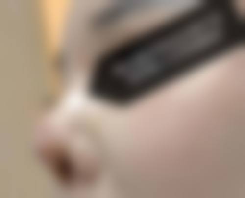 【徐州沃美医疗美容患者口碑评价:】