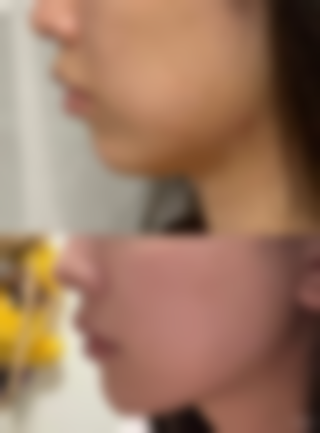 【秦皇岛侯医生美容整形诊所患者口碑评价：】