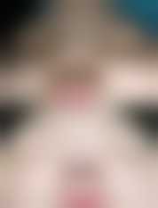 打瘦脸针多少钱