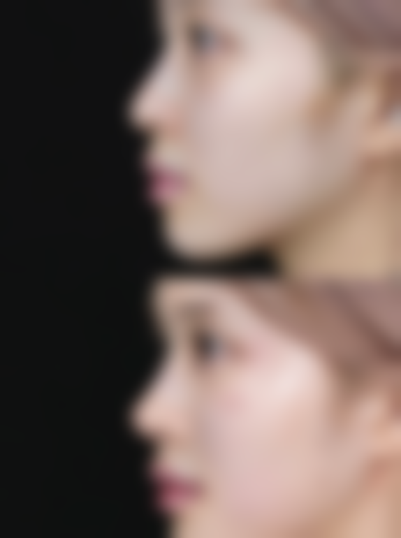 【徐州沃美医疗美容参考价格表:】