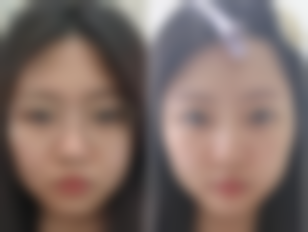 【深圳唯美星整形医疗美容诊疗设备:】