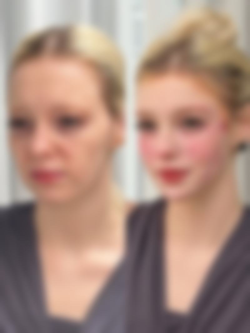 瘦脸针打完能洗脸吗？了解24小时黄金恢复期，掌握正确洗脸时间与方法，让瘦脸效果更显著！ 