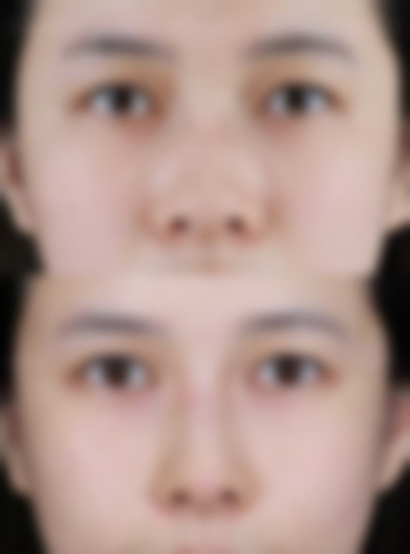 【青岛美丽海内外整形医院参考价格表:】