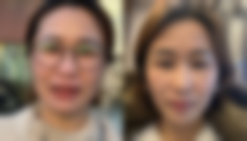 打完瘦脸针能泡澡吗女生