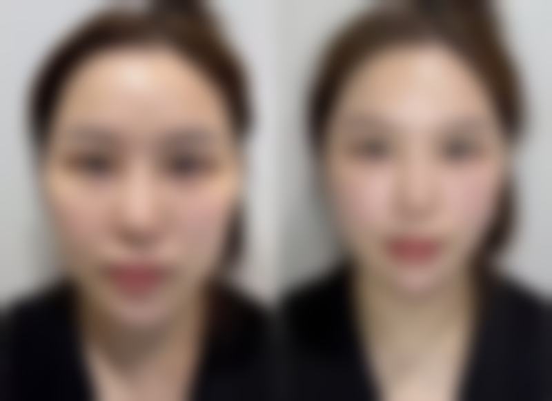 【深圳唯美星整形医疗美容特色项目:】