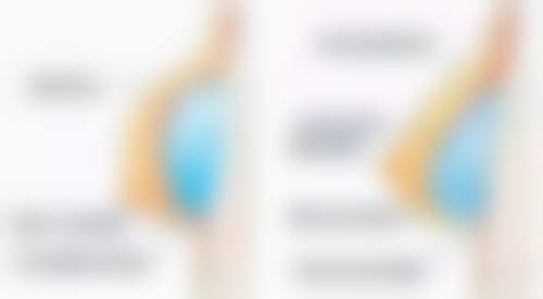 阴道紧缩手术后多久能同房