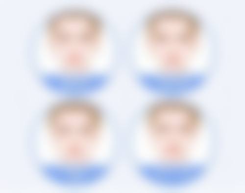 选择玻尿酸项目的建议