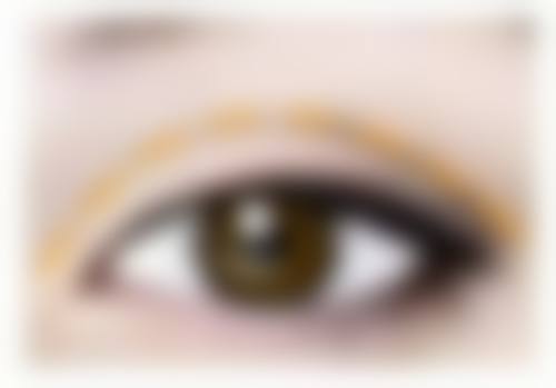 玻尿酸注射卧蚕可以维持多久